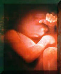 An establishment conspiracy on the unborn