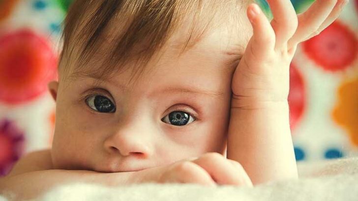 Births of babies with Down syndrome in Europe fall sharply amid increased prenatal testing